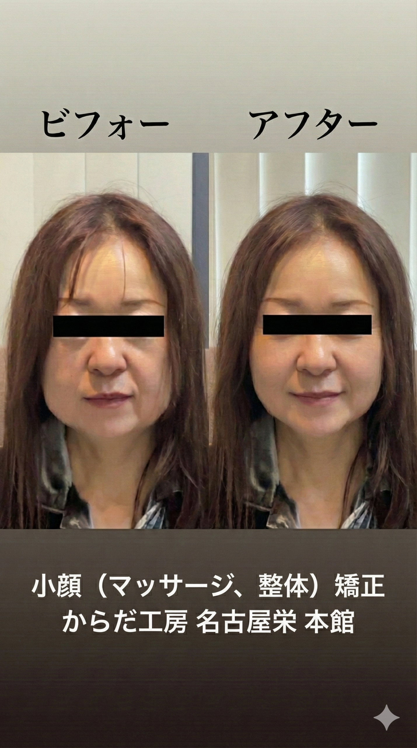 ビフォー 施術前